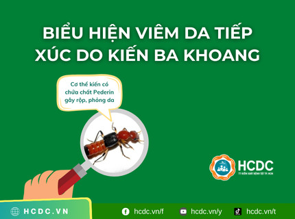 Biểu hiện viêm da tiếp xúc do kiến ba khoang
