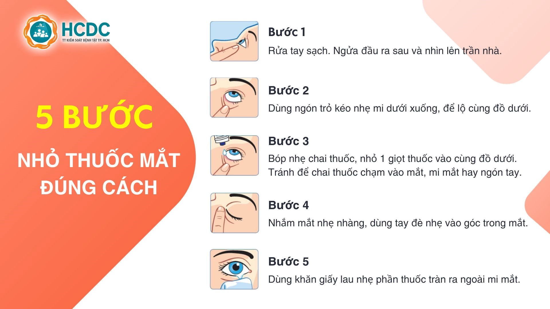 Đau mắt đỏ: Những điều cần lưu ý khi sử dụng thuốc nhỏ mắt