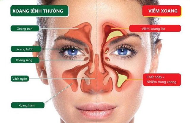 Điểm tin nhanh ngày 26/09/2022