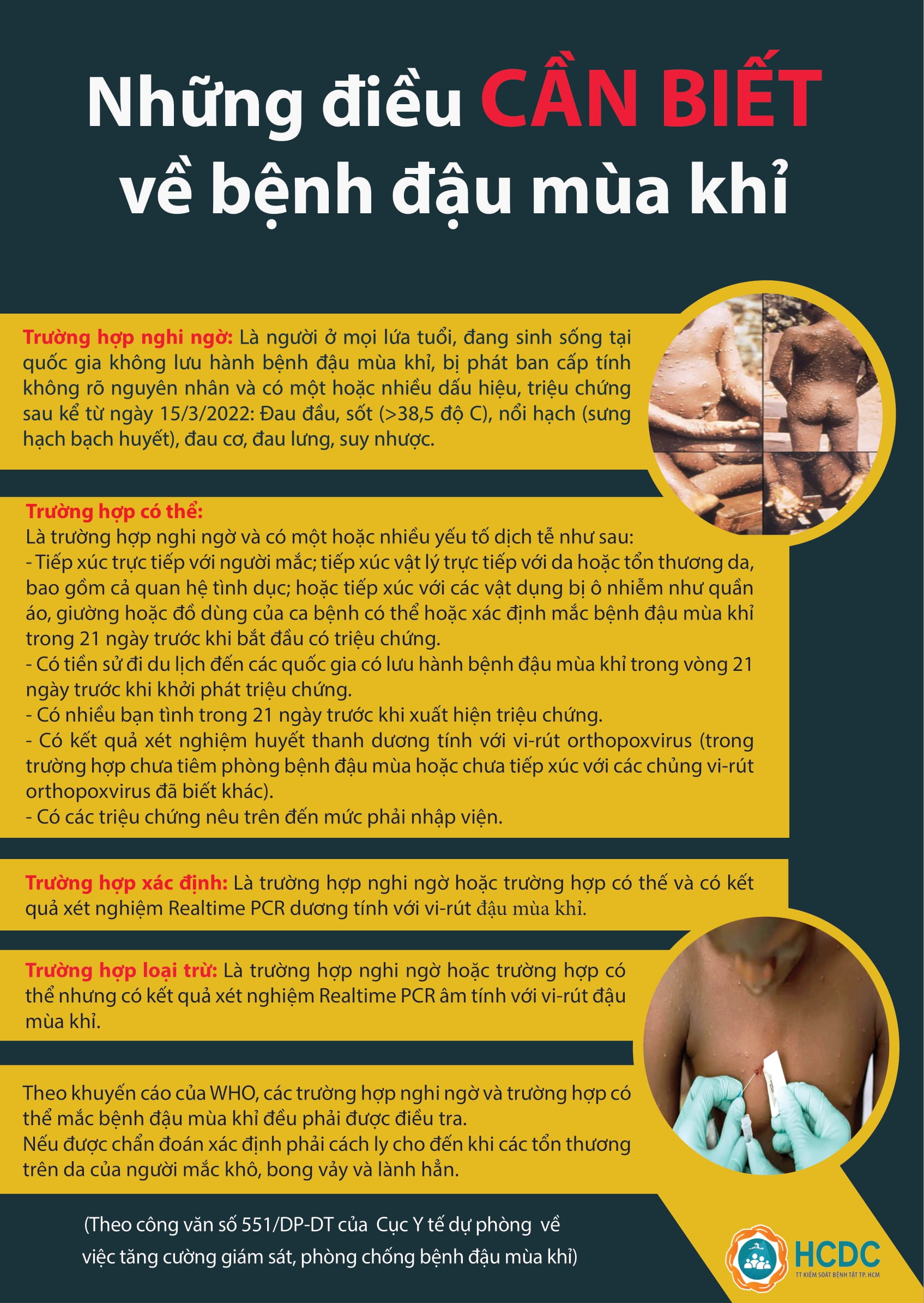 Những điều cần biết về bệnh đậu mùa khỉ