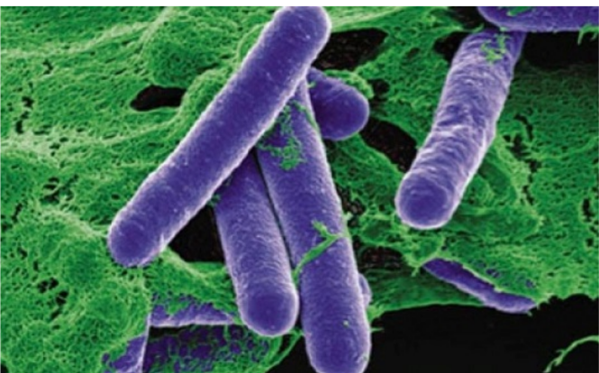 Những điều cần biết về ngộ độc botulinum