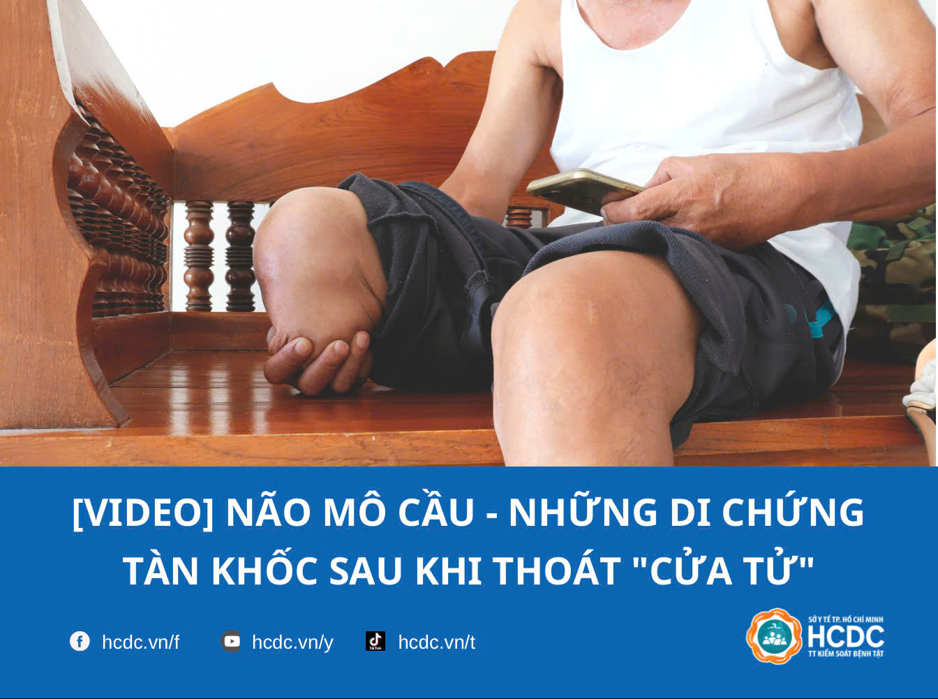 [Video] Não mô cầu - Những di chứng tàn khốc sau khi thoát "cửa tử"