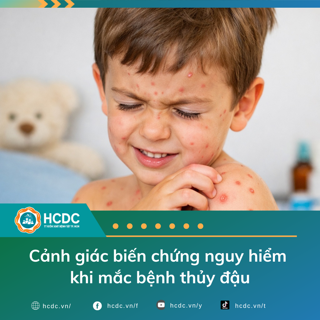Cảnh giác biến chứng nguy hiểm khi mắc bệnh thủy đậu