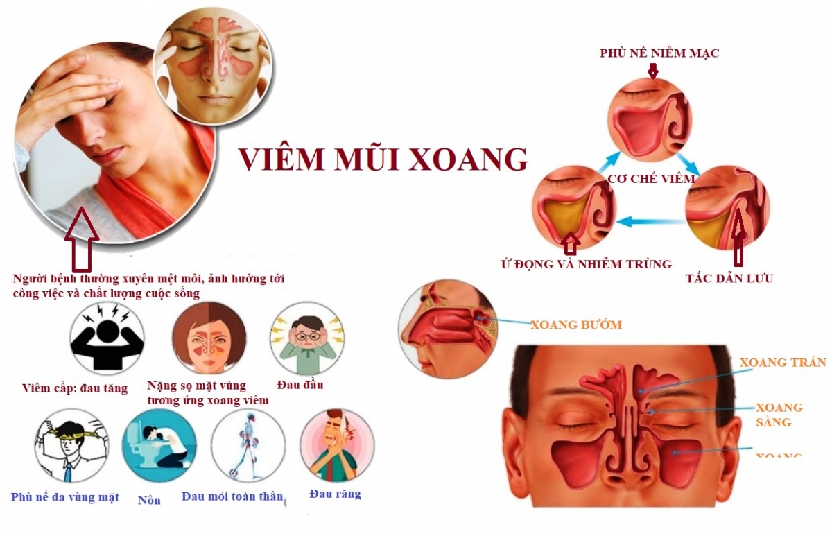Điểm tin nhanh ngày 08/02/2023