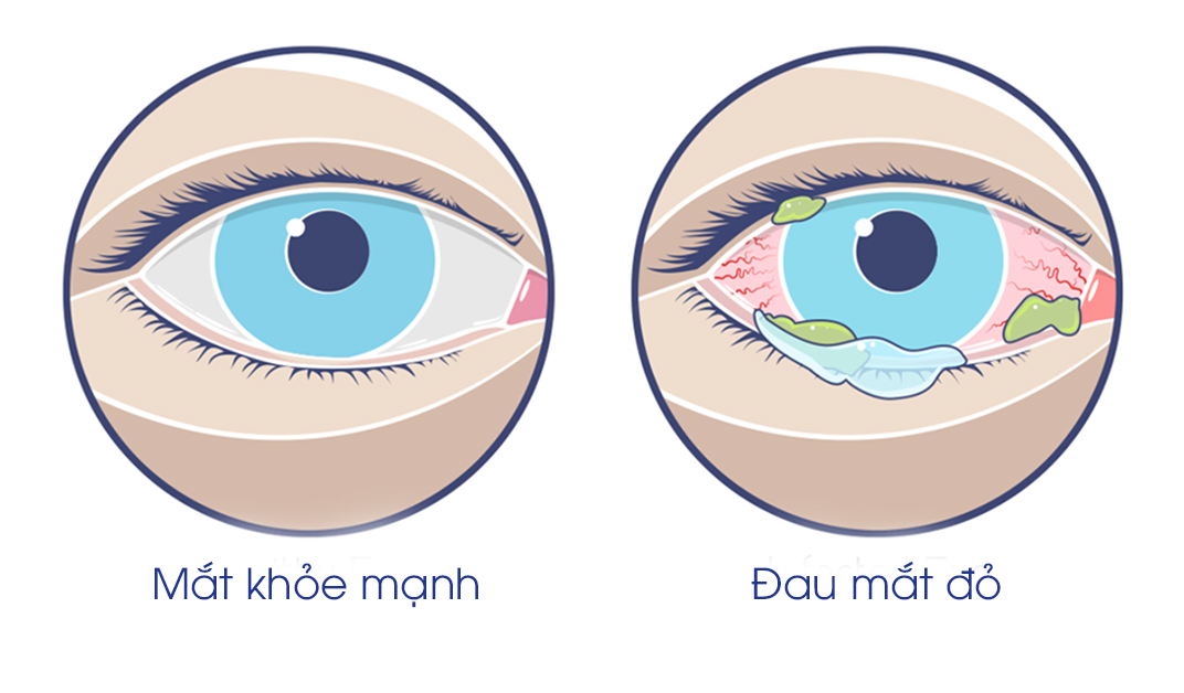 Điểm tin nhanh ngày 10/09/2023