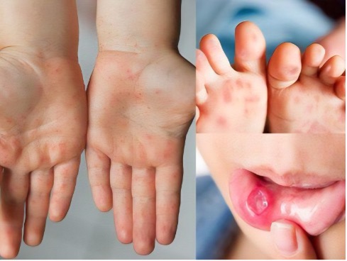 Điểm tin nhanh ngày 20/03/2026