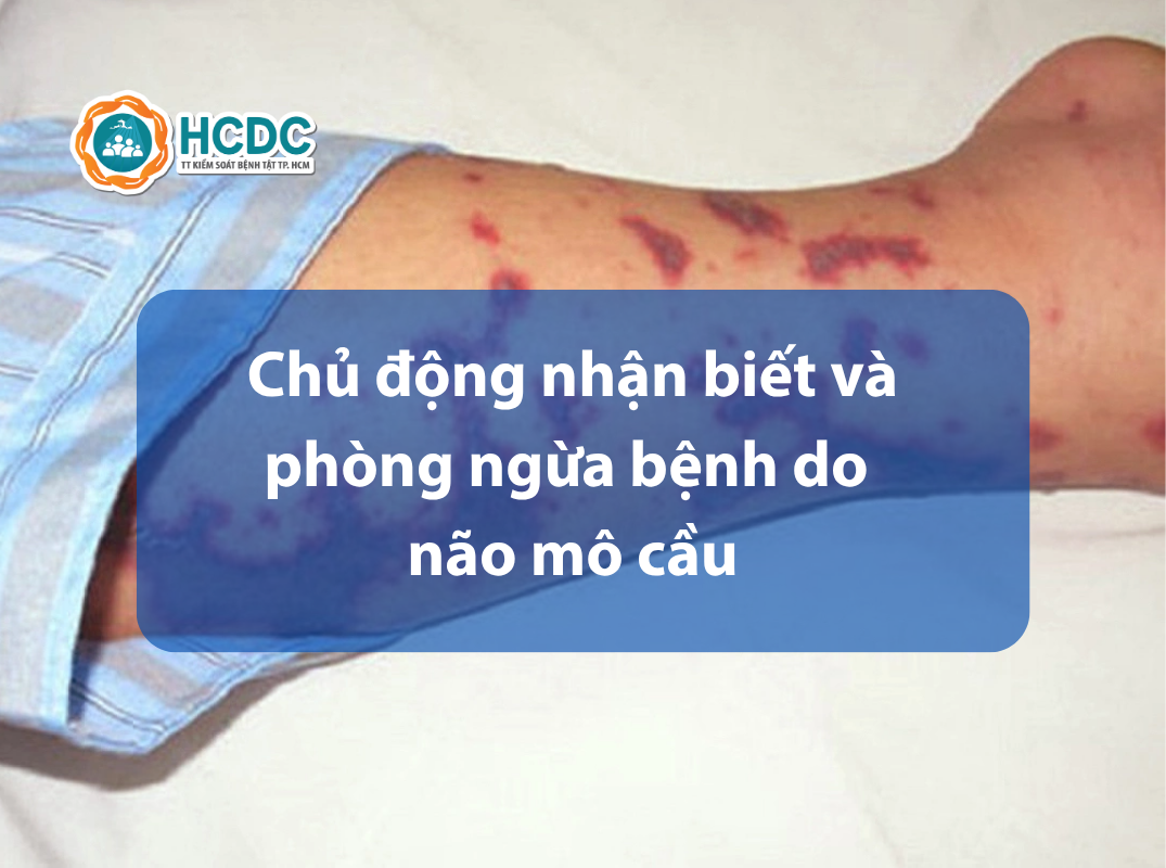 Chủ động nhận biết và phòng ngừa bệnh do não mô cầu