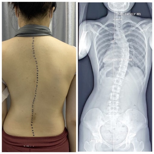 Điểm tin nhanh ngày 19/6/2023