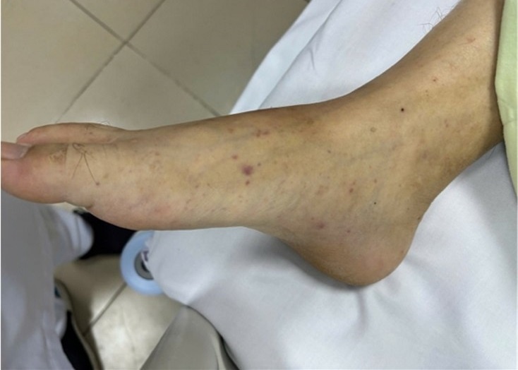 Điểm tin nhanh ngày 23/3/2026