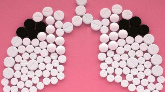 Điều trị lao: Cần sự tuân thủ nghiêm ngặt chỉ định của bác sỹ 