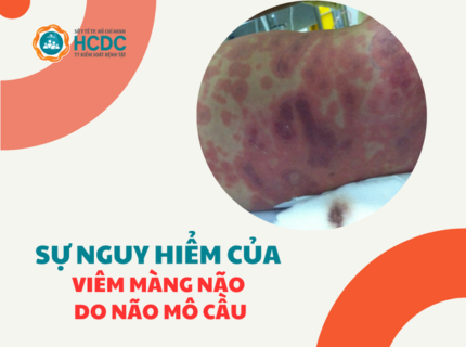 Sự nguy hiểm của bệnh viêm màng não do não mô cầu