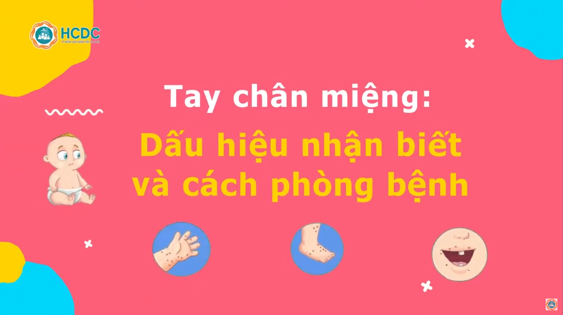 Tay chân miệng: Dấu hiệu nhận biết và cách phòng bệnh