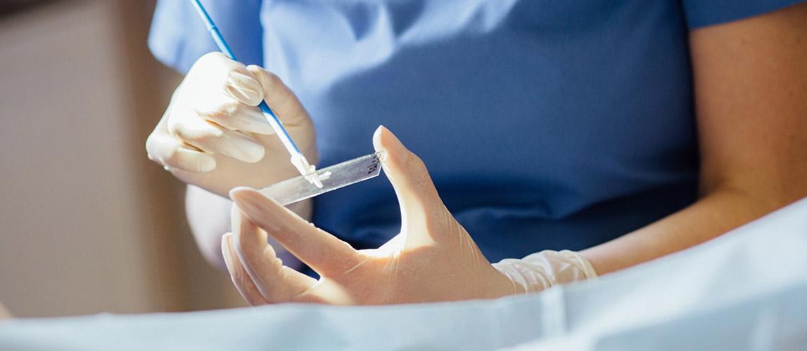 Ung thư cổ tử cung có thể điều trị khỏi nếu được phát hiện sớm